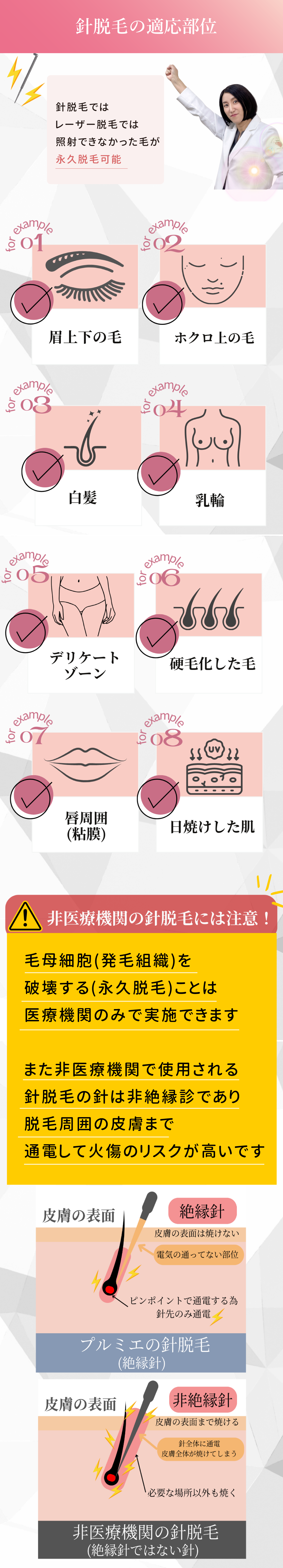 針脱毛の適応部位