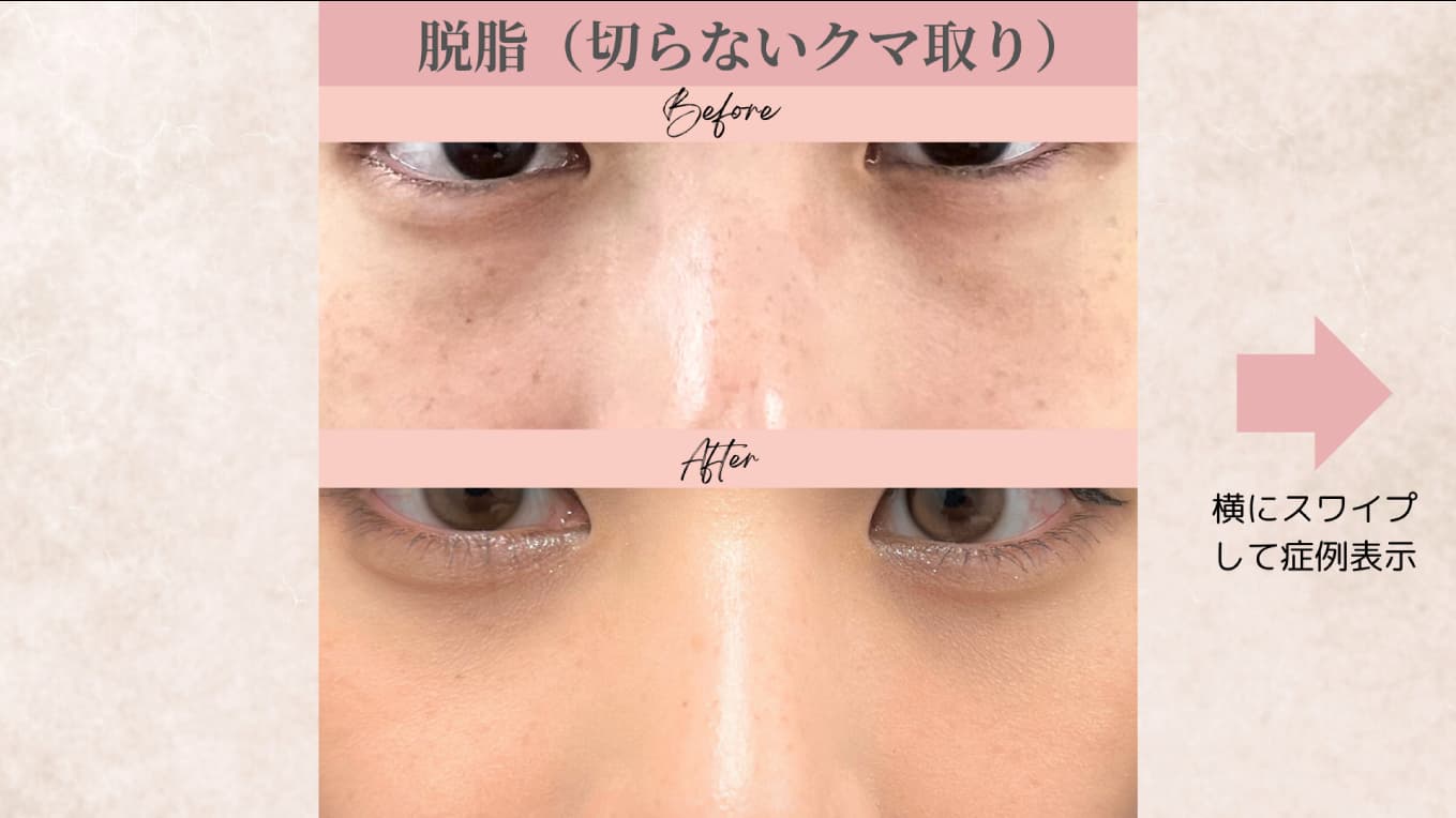 キービジュアル