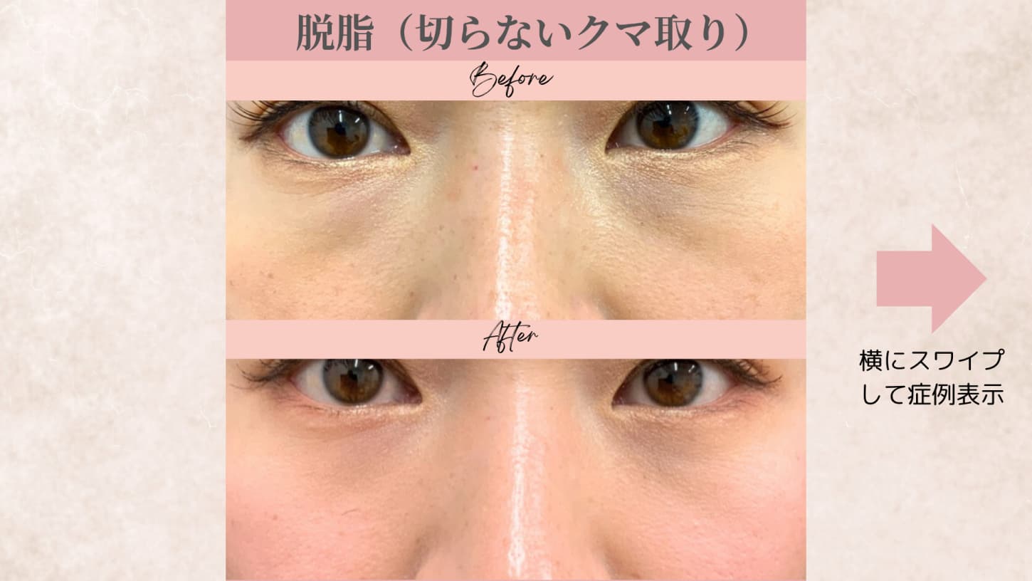 キービジュアル