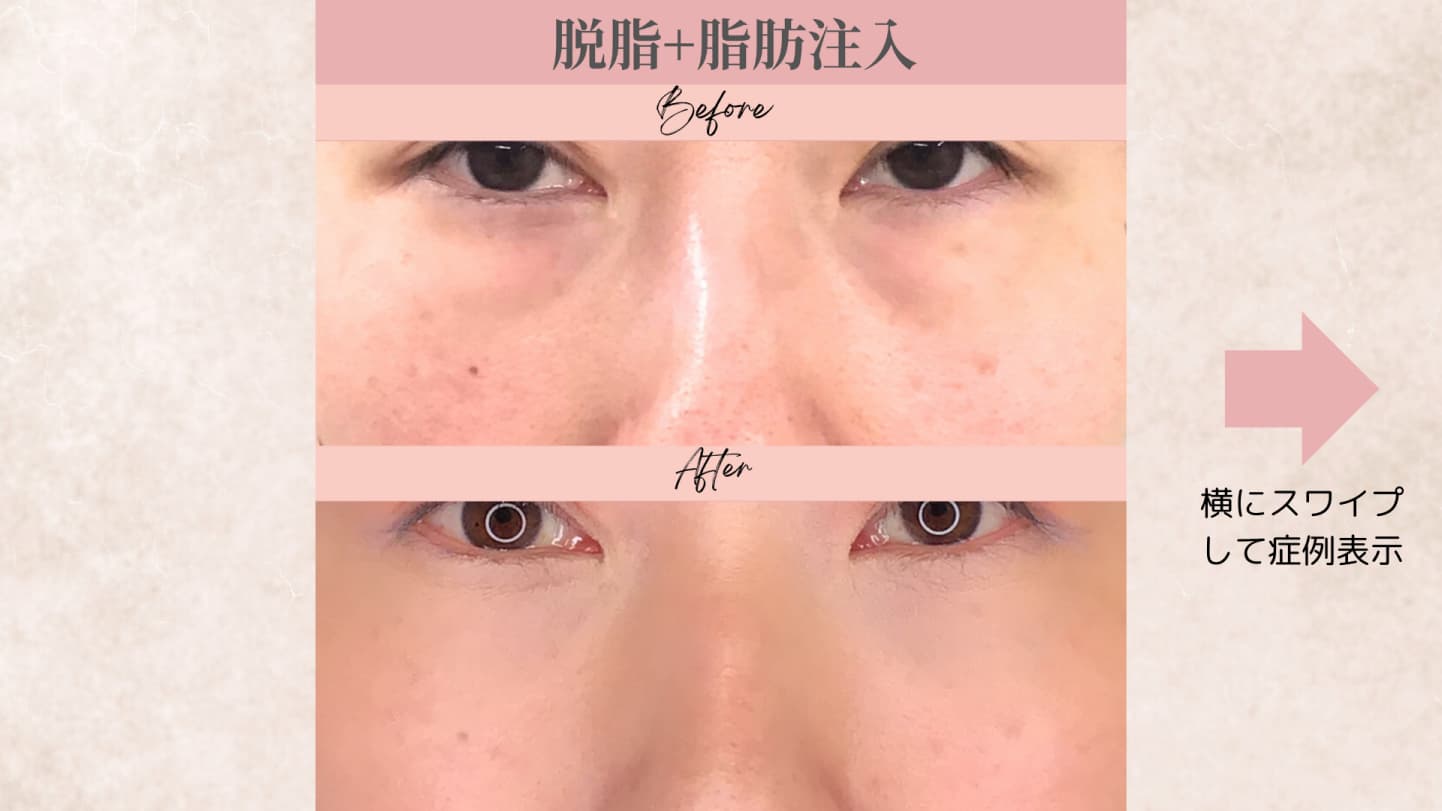 キービジュアル