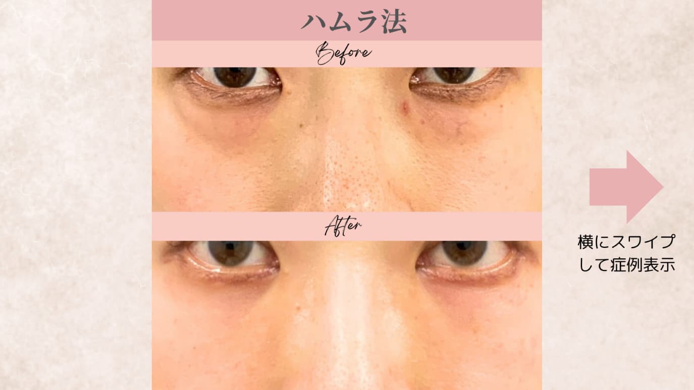 キービジュアル