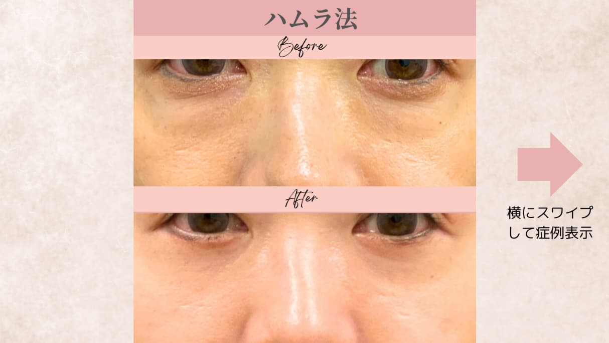 キービジュアル